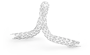 Allium Stent